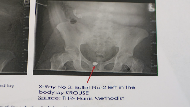 Defense attorneys call for probe into troubled Tarrant County ME’s Office