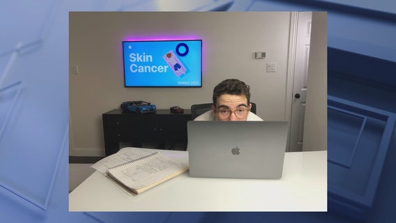 Frisco teen selected for Apple scholarship after creating skin cancer app
