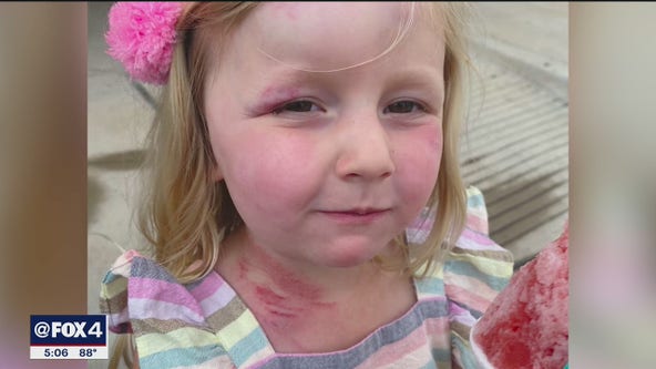 Man whose daughter was injured during evacuation at NorthPark Center describes what they went through