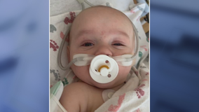North Texas 4-month-old in ICU battling COVID-19 and RSV simultaneously