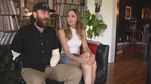 Benefit concert organized for Dallas musician who became a double amputee