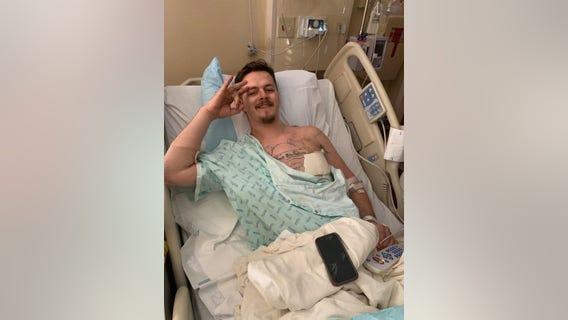 Man hit by stray bullet in Uptown Dallas recovering from collapsed lung, broken ribs