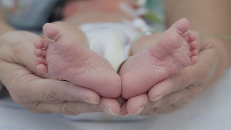 File - legs of a newborn baby held by adult hands in hospital. (Photo by: Marta Beren/Vwpic/Universal Images Group via Getty Images)