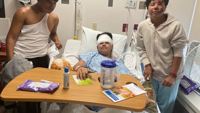 Third teen who survived deadly hit-and-run crash in Dallas released from hospital
