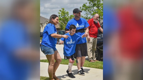 North Texas burn survivor promotes fire safety after "stop, drop and roll" lesson saved his life