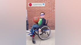 6-year-old North Texas amputee featured in JC Penney ad