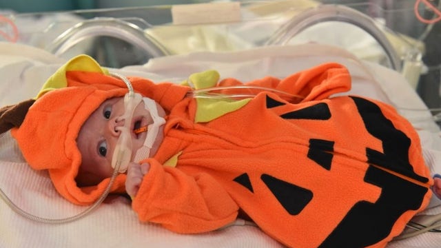 North Texas NICU babies get dressed up for first Halloween