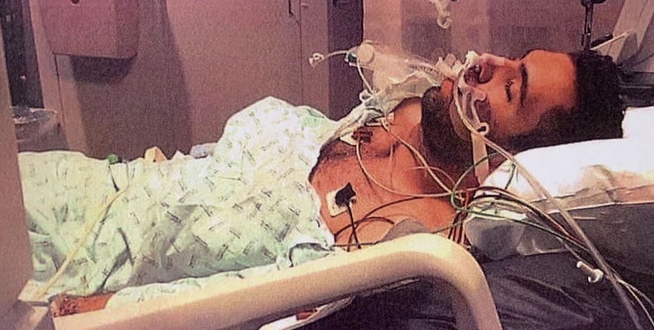 Man In Coma