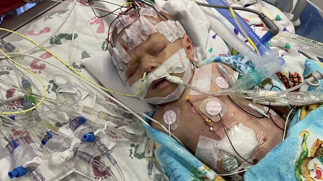 Dallas boy with rare heart defect nicknamed 'Frank the Tank' on road to recovery