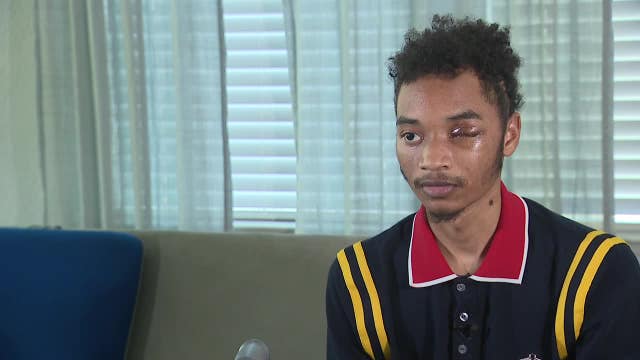 Dallas 7-Eleven shooting victim loses eye, crushing chances to join the Navy