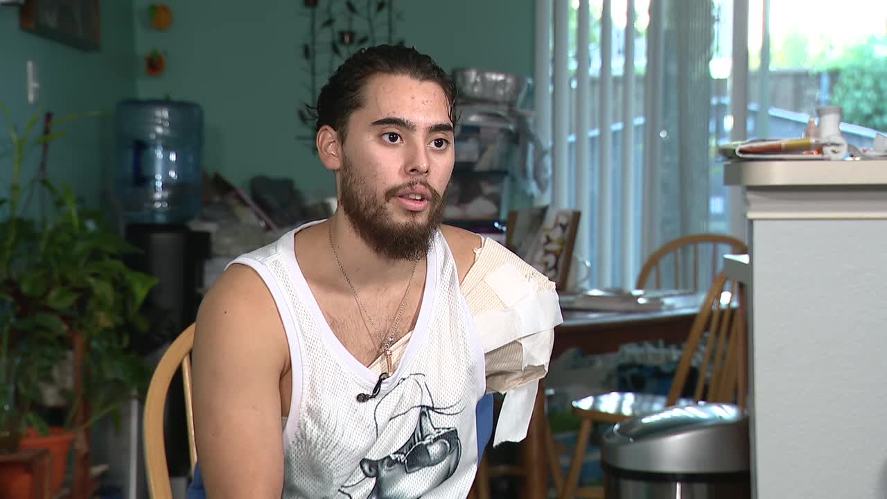 Little Elm man has arm amputated after hit-and-run crash but keeps positive outlook - Vimarsana News