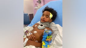Family of boy hurt in Dallas hit-and-run crash hopes driver involved is caught