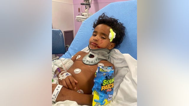 Family of boy hurt in Dallas hit-and-run crash hopes driver involved is caught