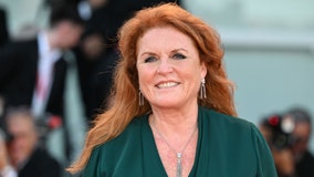 Sarah Ferguson, Duchess of York, diagnosed with malignant melanoma