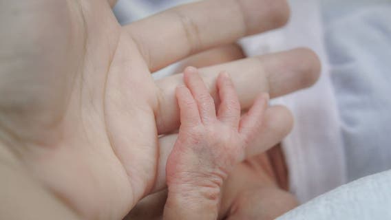 Texas leads cases in infant botulism outbreak from baby formula