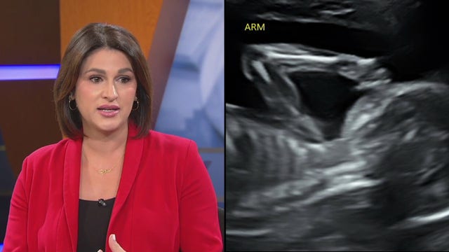 Shannon Murray shares update on unborn daughter's health condition