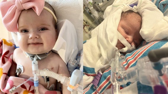 Virginia infant awaits life-saving double lung transplant at Texas Children’s