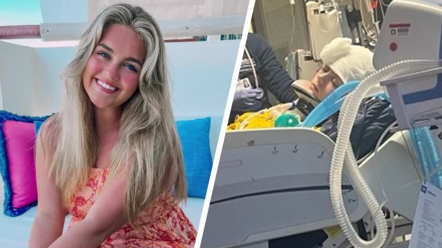 Dallas woman beating the odds as she recovers from hit-and-run crash that killed roommate