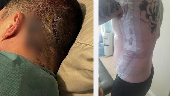 Fort Worth train conductor nearly stabbed to death wins $3 million lawsuit