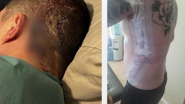 Fort Worth train conductor nearly stabbed to death wins $3 million lawsuit