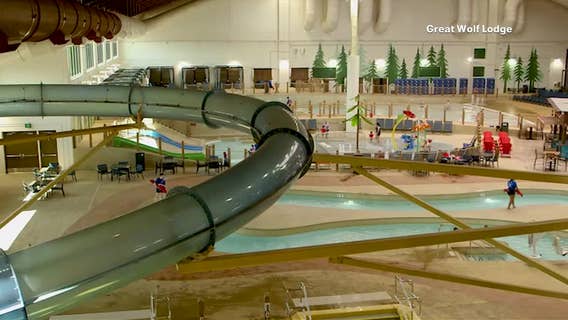 Tarrant County measles exposure raises concerns from health officials