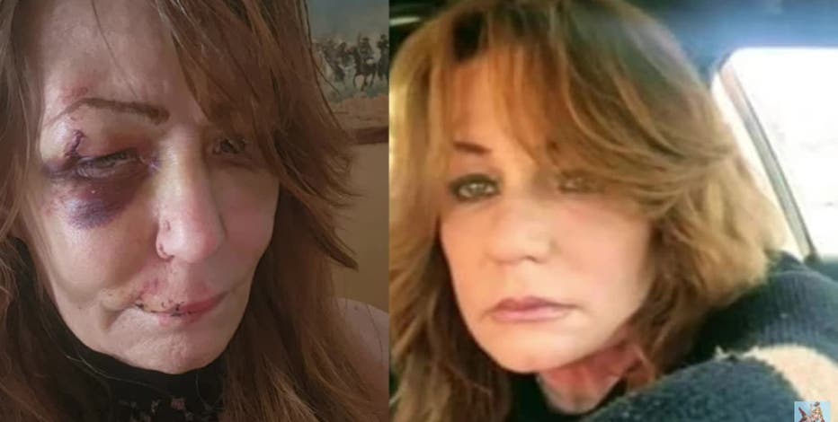 Police union defends Fort Worth officer fired for injuring woman during arrest