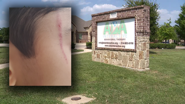North Richland Hills therapist accused of assaulting autistic 7-year-old boy