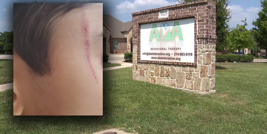 North Richland Hills therapist accused of assaulting autistic 7-year-old boy