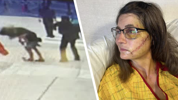 Woman hurt in brutal Downtown Dallas attack left with cognitive issues, facial fractures