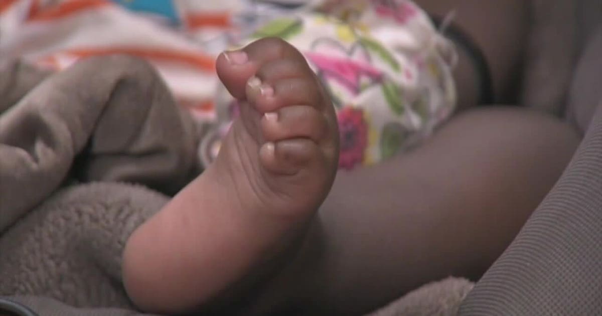 Infant RSV cases on the rise in DFW, doctors say | FOX 4 Dallas-Fort Worth