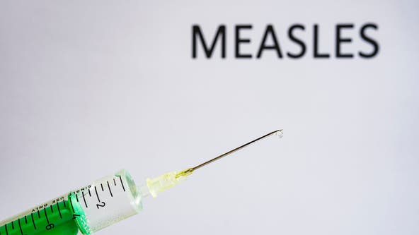 Texas measles outbreak 2025: More than 300 cases detected in state