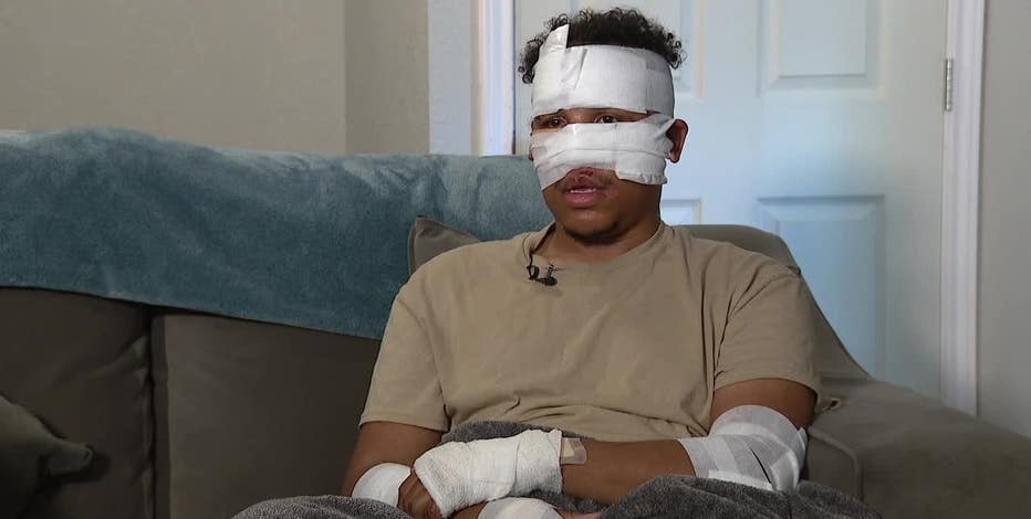 Cleburne man riding new motorcycle home nearly killed in hit-and-run crash