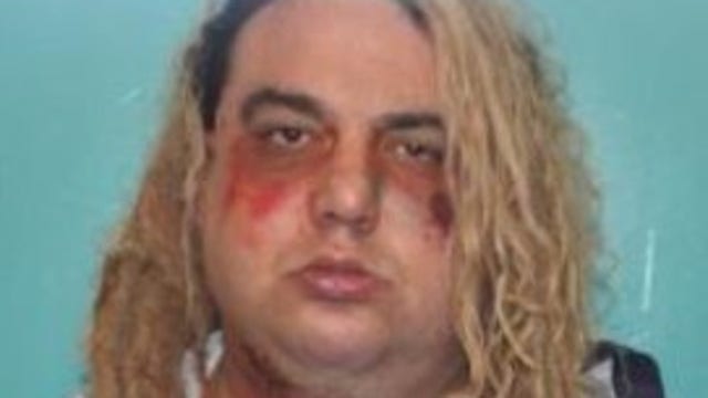 Dallas man injured, arrested in Allen officer-involved shooting