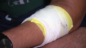 Random stabbing in Frisco neighborhood leaves teen injured