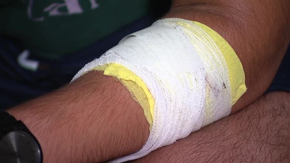 Random stabbing in Frisco neighborhood leaves teen injured