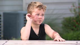 Trackdown: Police search for driver in hit-and-run that injured 8-year-old