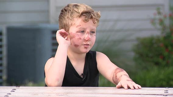 Trackdown: Police search for driver in hit-and-run that injured 8-year-old