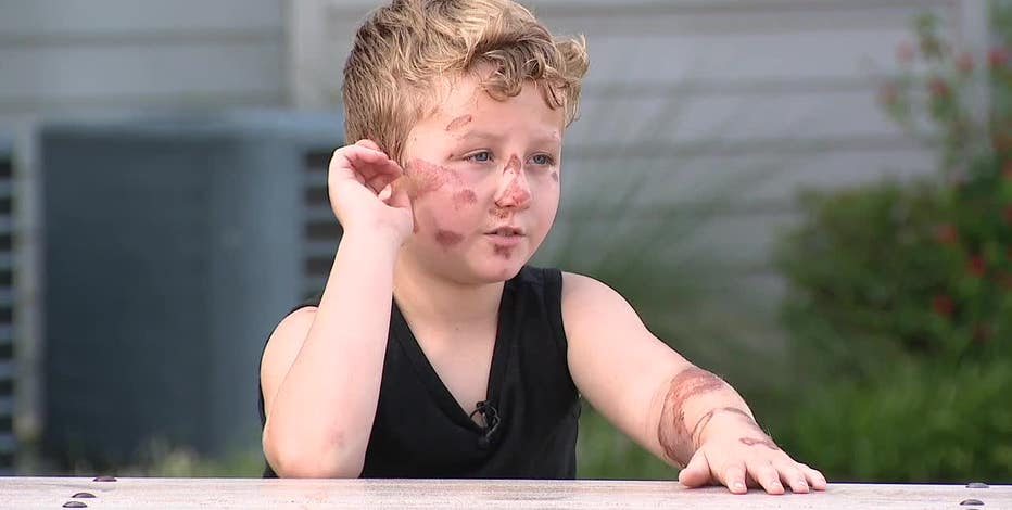 Trackdown: Police search for driver in hit-and-run that injured 8-year-old