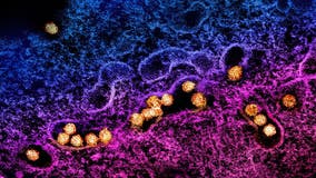 Dallas County reports 1st West Nile Virus death of season; Officials urge caution