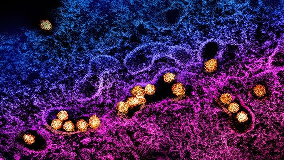 Dallas County reports 1st West Nile Virus death of season; Officials urge caution