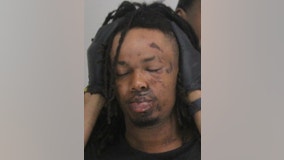 18-year-old suspect charged for DART train shooting