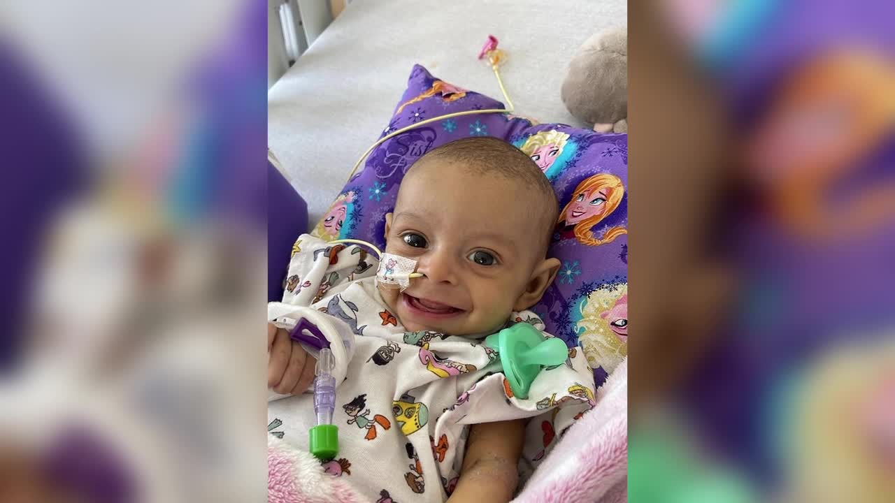 Complex liver transplant saves 2 lives with a single organ donation