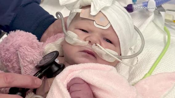 Fort Worth doctor saves the life of baby with rare heart defect