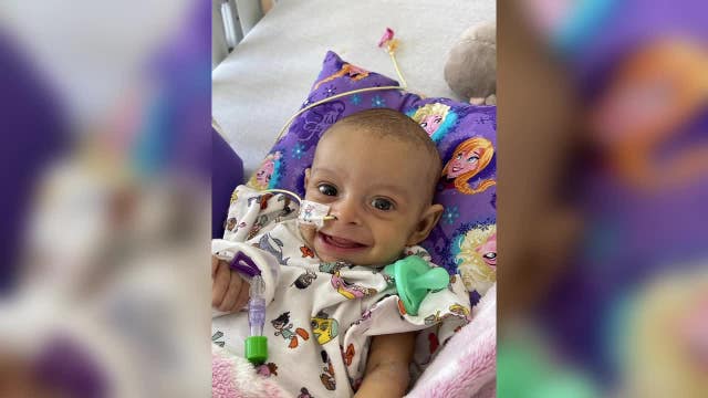 Complex liver transplant saves 2 lives with a single organ donation