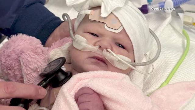 Fort Worth doctor saves the life of baby with rare heart defect
