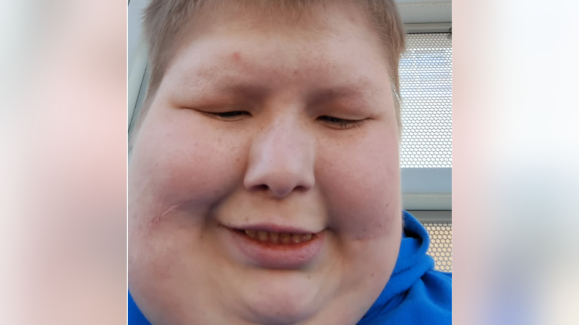 Texas officials searching for endangered missing man in Dallas