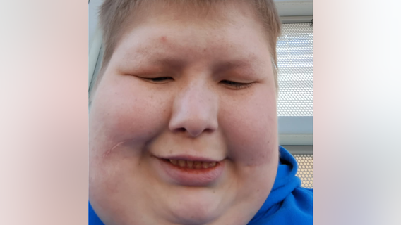 Texas officials searching for endangered missing man in Dallas