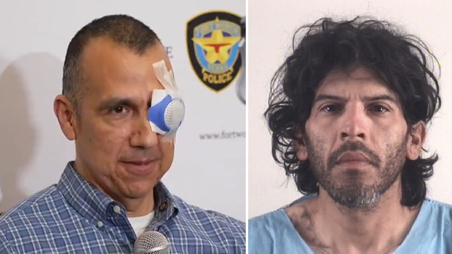 Fort Worth CRU officer reflects on neighborhood shooting that left his eye injured