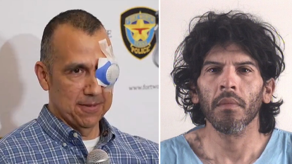 Fort Worth civilian officer reflects on neighborhood shooting that left his eye injured