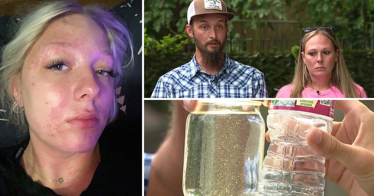 Trinidad family says daughter suffered chemical burn after showering with city's water